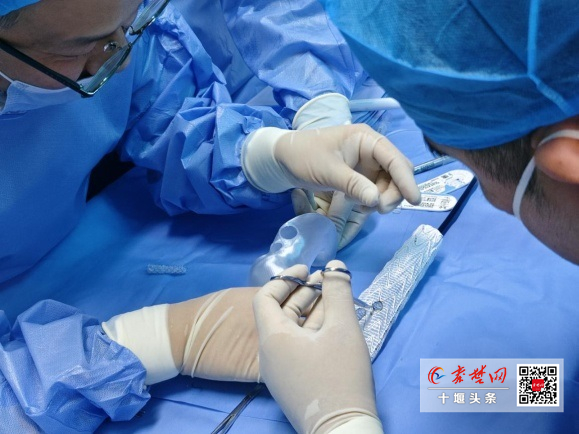 3D打印技術(shù)助力復(fù)雜手術(shù)，十堰人醫(yī)為89歲高齡患者拆除動脈瘤
