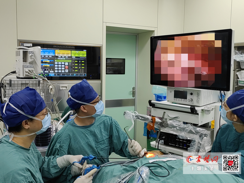 告別面部疤痕！十堰人醫(yī)引領(lǐng)鄂西北腮腺腫瘤治療邁入“無痕”時代