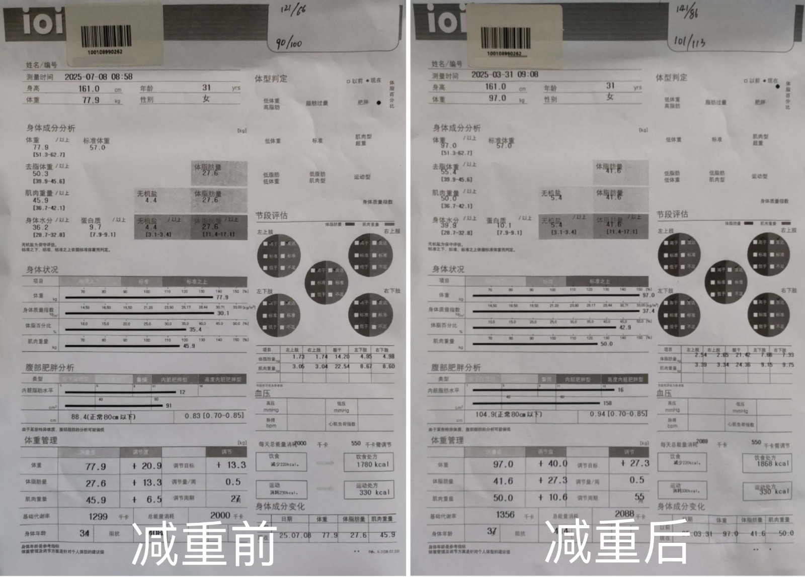 女子科學共管減重19公斤，逆轉(zhuǎn)代謝危機