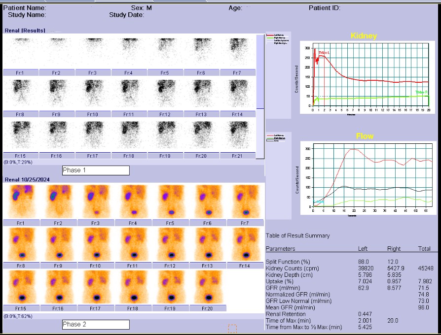 腎動(dòng)態(tài)顯像檢查流程及注意事項(xiàng)